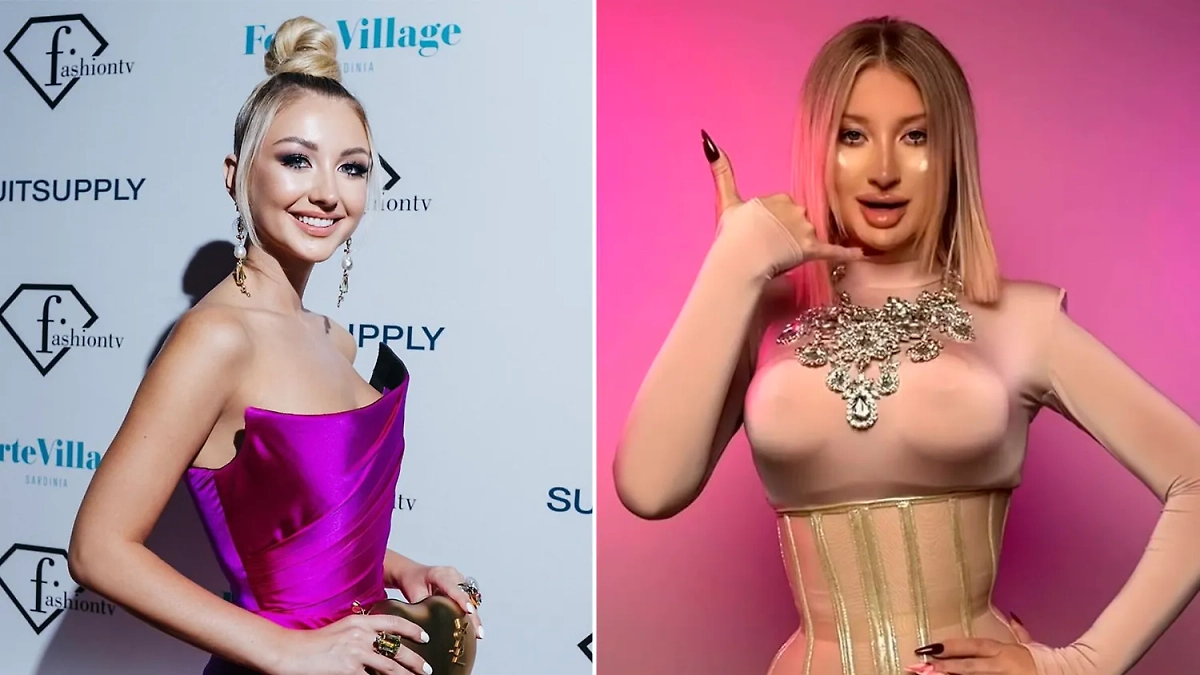 Марго Овсянникова испортила внешность пластическими операциями. Фото © Instagram (признан экстремистской организацией и запрещён на территории Российской Федерации) / mmmargaaret