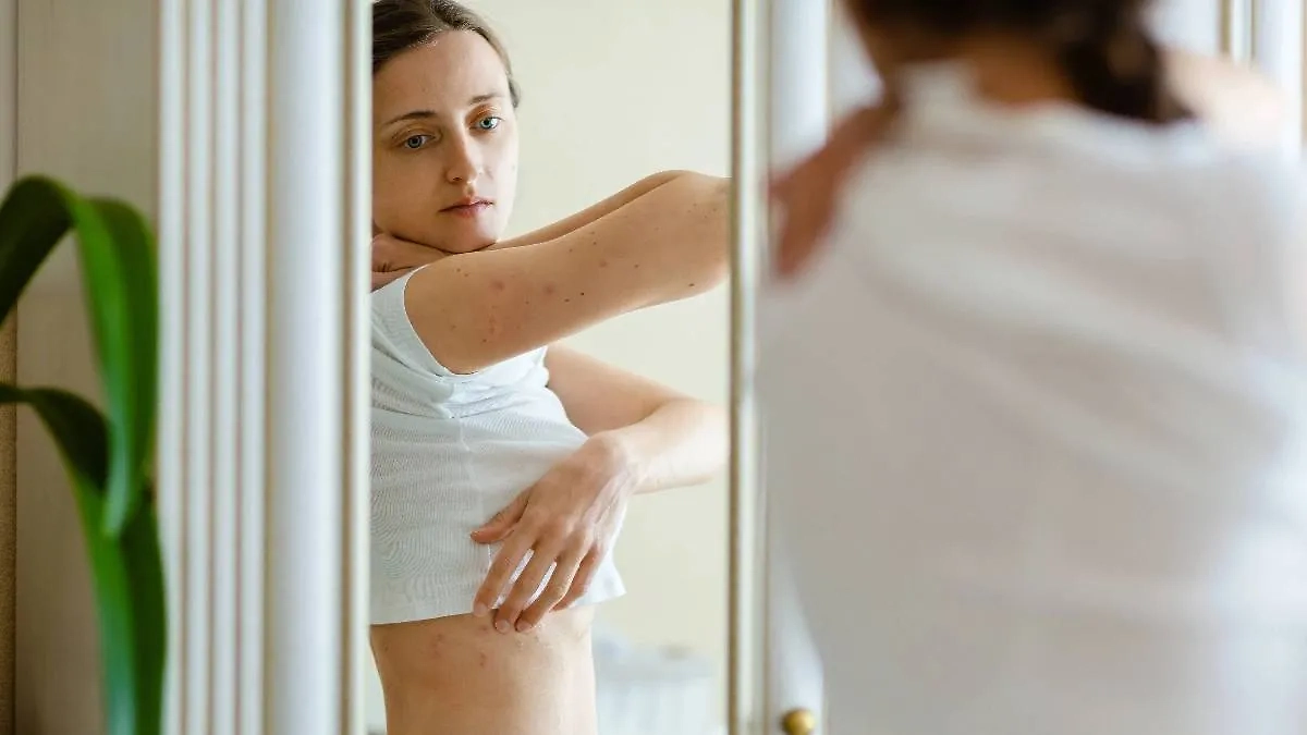 29 октября — Международный день псориаза. Фото © Shutterstock / FOTODOM / ShineTerra