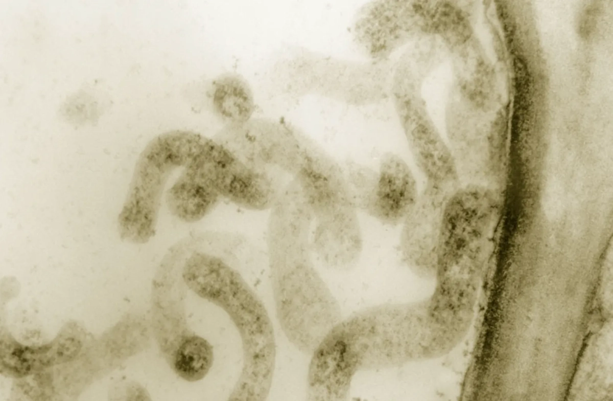 Микоплазменную пневмонию вызывают микроорганизмы. Фото © Wikipedia 