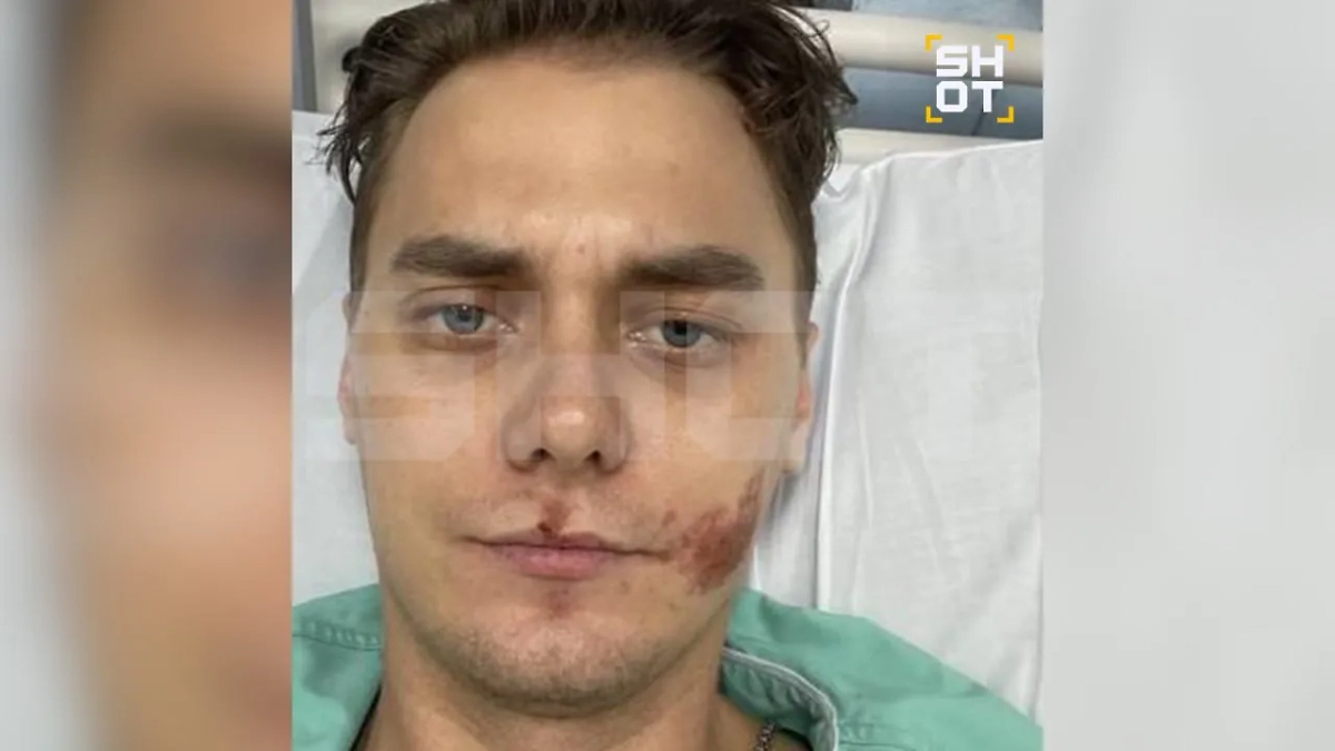 Россиянин, пострадавший в Таиланде. Фото © SHOT