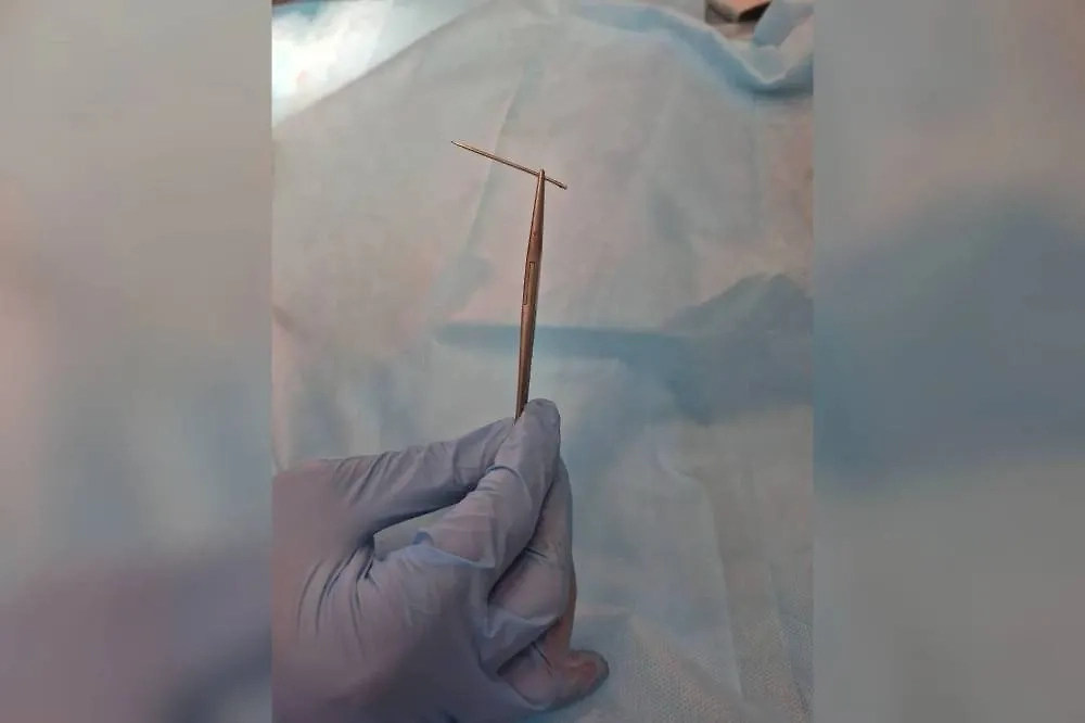 10-летний мальчик наступил на одну из иголок. Фото © Предоставлено Life.ru