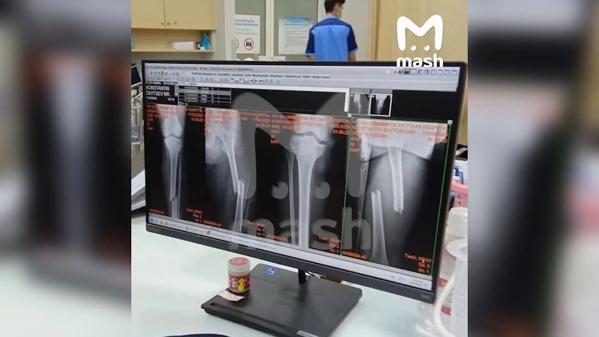 Российский подросток в Таиланде нуждается в помощи после аварии. Фото © Mash