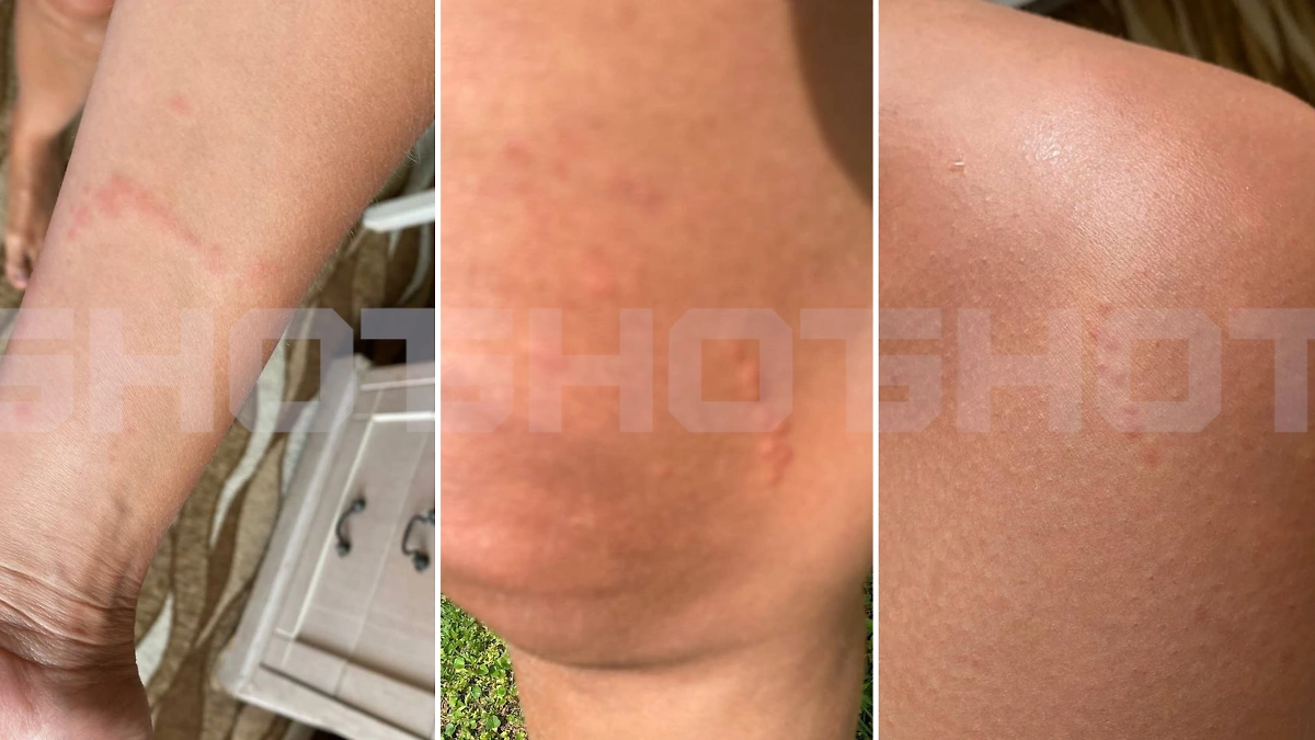 Следу от медуз. Фото © SHOT