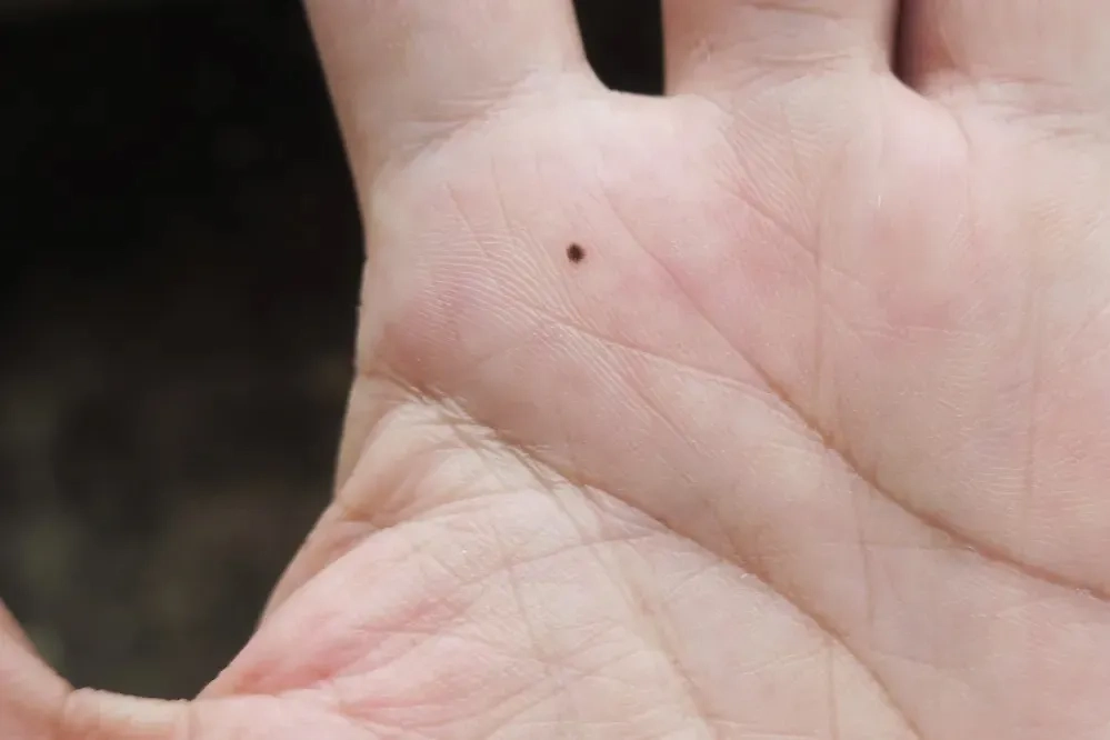 Что означает родинка на ладони? Фото © Shutterstock / FOTODOM / TA BLUE Capture