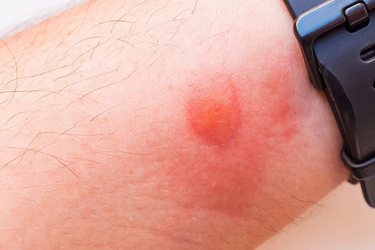 По сравнению с оводом слепень — простой большой и безобидный добряк. Фото © Shutterstock / FOTODOM / Yevhen Prozhyrko