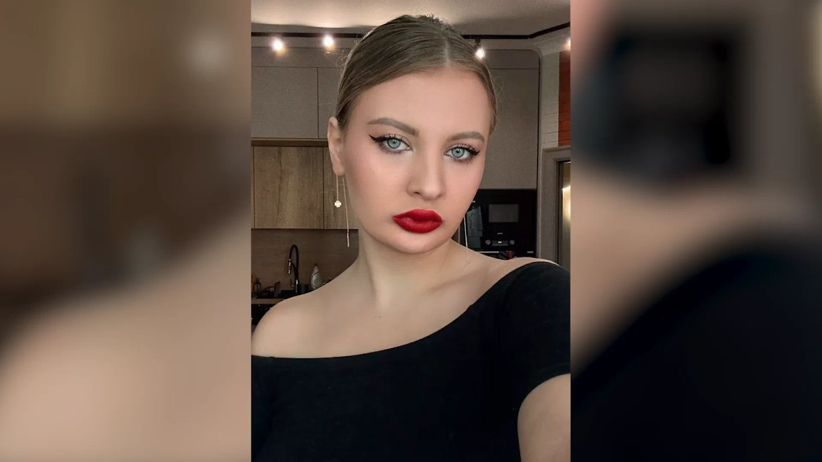 Невестка Наташи Королёвой показала, как выглядит после нескольких операций на челюсть. Обложка © Instagram (признан экстремистской организацией и запрещён на территории Российской Федерации) / melissa_foxs_