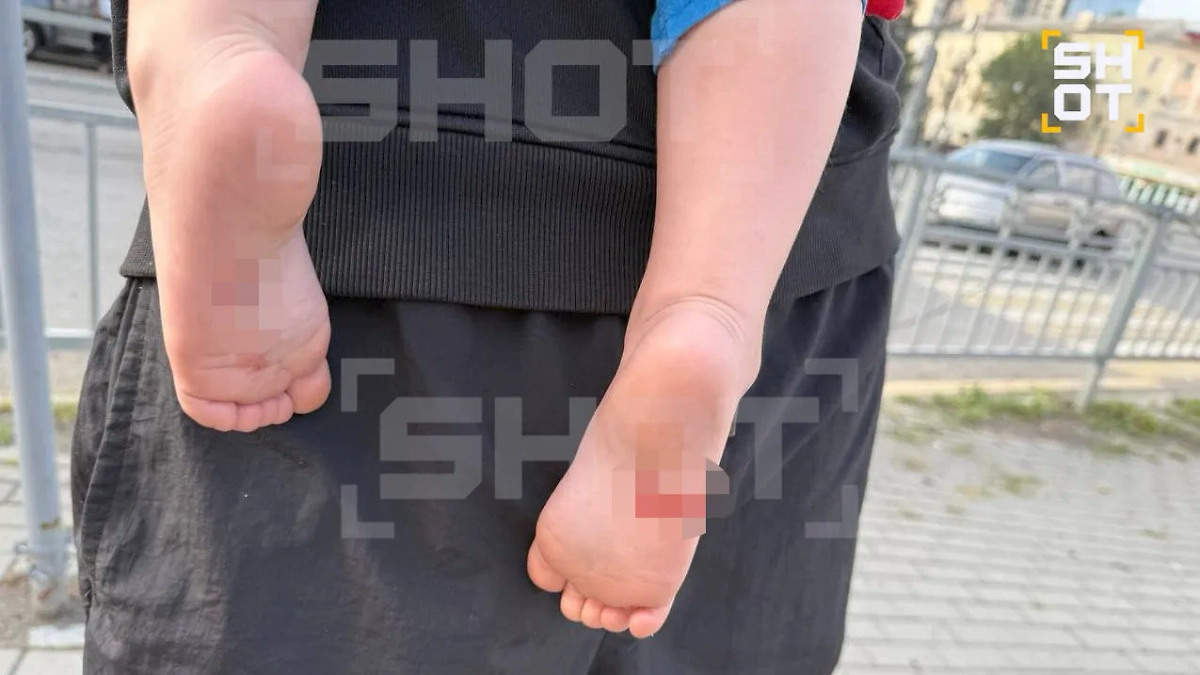 Из-за атаки беспилотников на Воронеж пострадал годовалый ребёнок. Фото © Telegram / SHOT