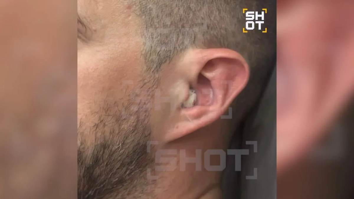 Житель Томска оглох после купания в местной речке. Фото © SHOT