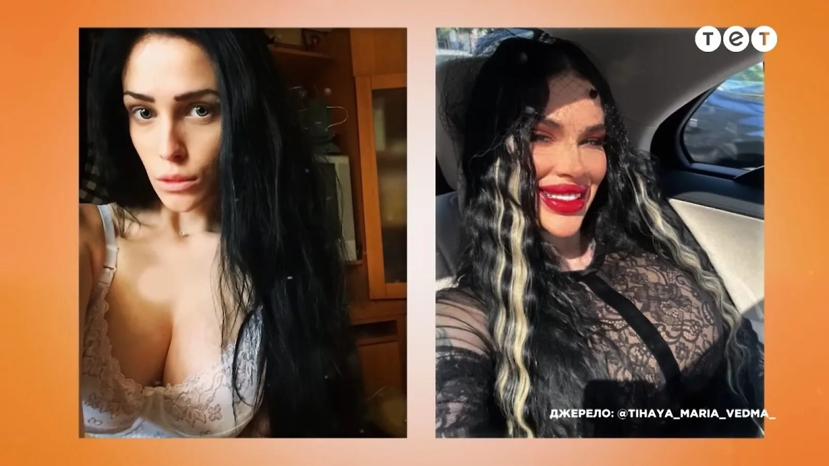 Тихая до и после участия в украинской «Битве экстрасенсов». Фото © noviydoctor.com