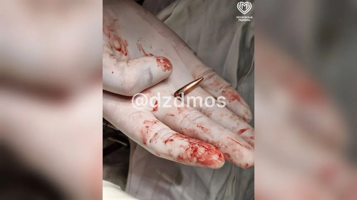 Из Курской области в Москву доставили раненного с пулей в вене. Фото © Telegram /  Московская медицина