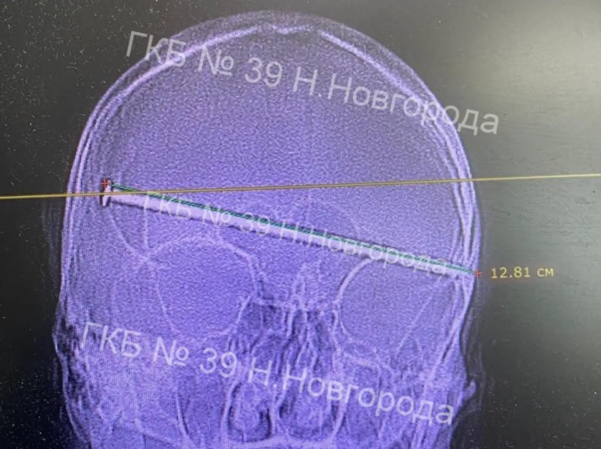 Фото © Городская клиническая больница №39 Н.Новгорода