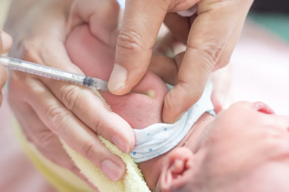 Как отличить поколение X от миллениала или зумера? По рубцу от БЦЖ, очевидно. Шрамы украшают настоящего советского человека. Фото © Shutterstock / FOTODOM / Akkalak Aiempradit