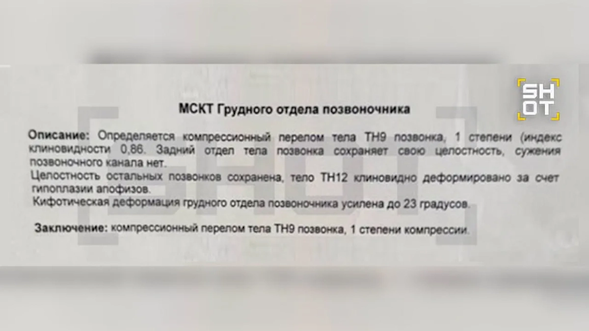 Жительница Екатеринбурга сломала позвоночник, снимая тренд под песню Ники Минаж. Фото © SHOT