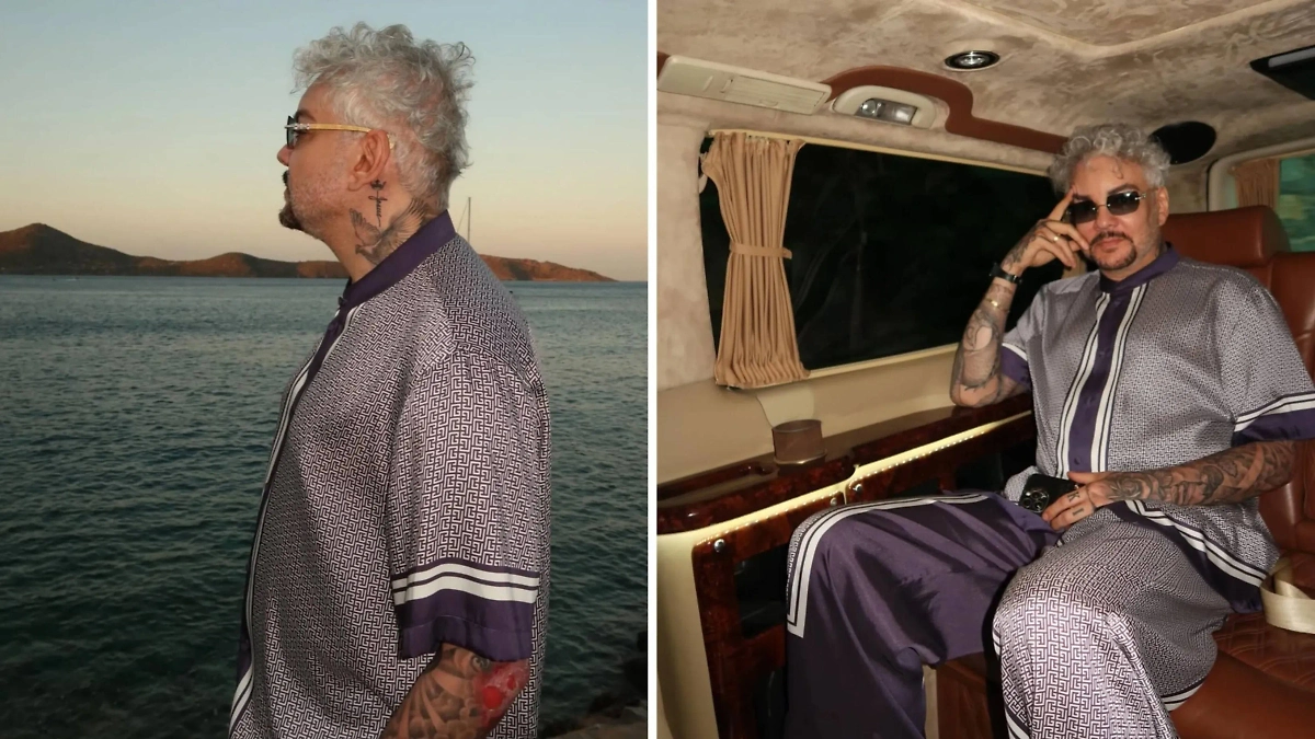 Киркоров Филипп: недавно артист показал фотографию ожога, перепугал этим поклонников. Фото © Instagram (признан экстремистской организацией и запрещён на территории Российской Федерации) / fkirkorov