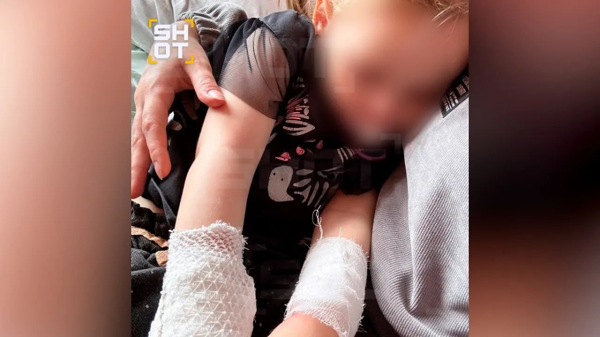 В Мурманске собака породы басенджи напала на двухлетнюю девочку. Фото © SHOT