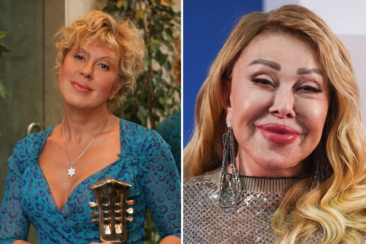 Знаменитости, которые испортили себя пластикой в России. Фото © ТАСС / Анвар Галеев, Сергей Булкин