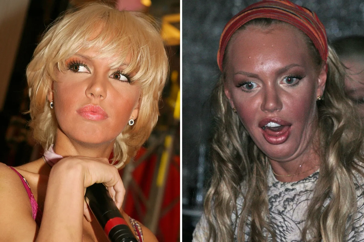 Звёзды, которые пожалели о пластике: российские знаменитости. Фото © ТАСС / Евгений Евгранов, Олег Дьяченко