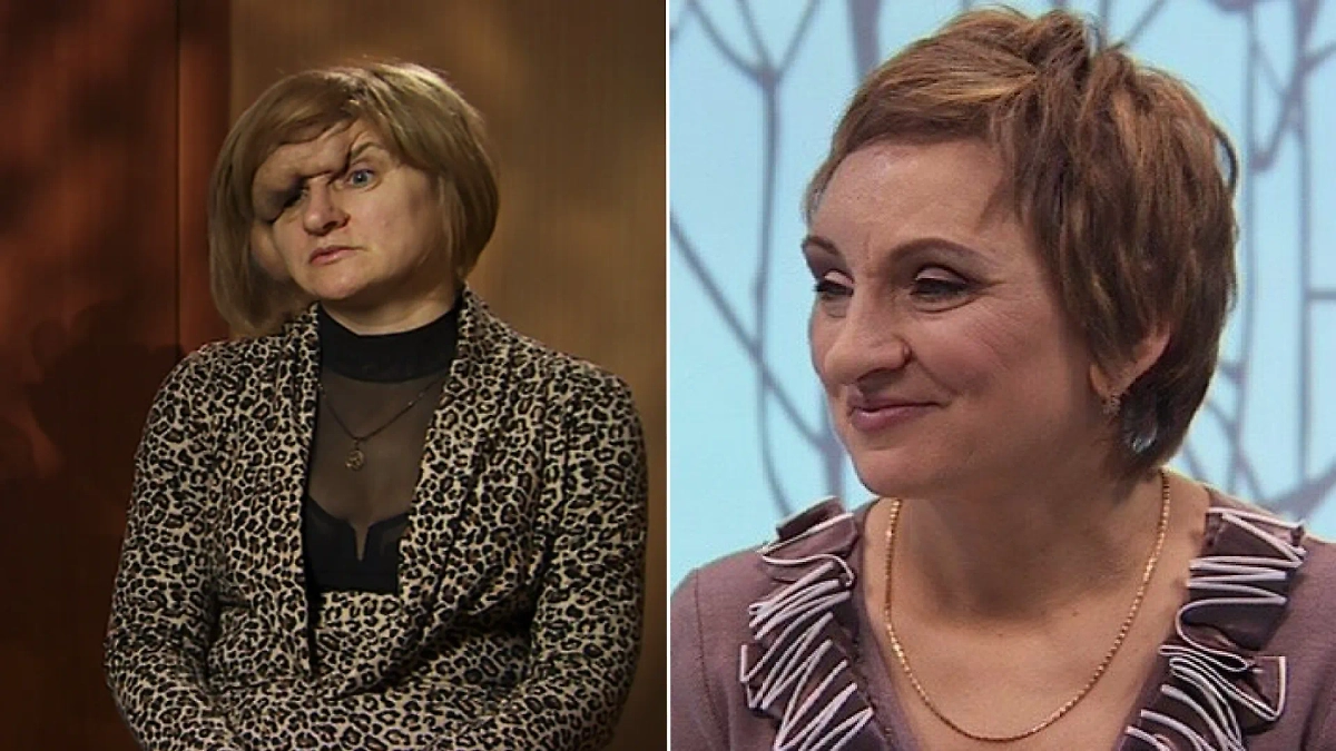 Как врачи проекта «Я стесняюсь своего тела» изменили жизни людей. Кадры из видео © YouTube / Телеканал СТБ