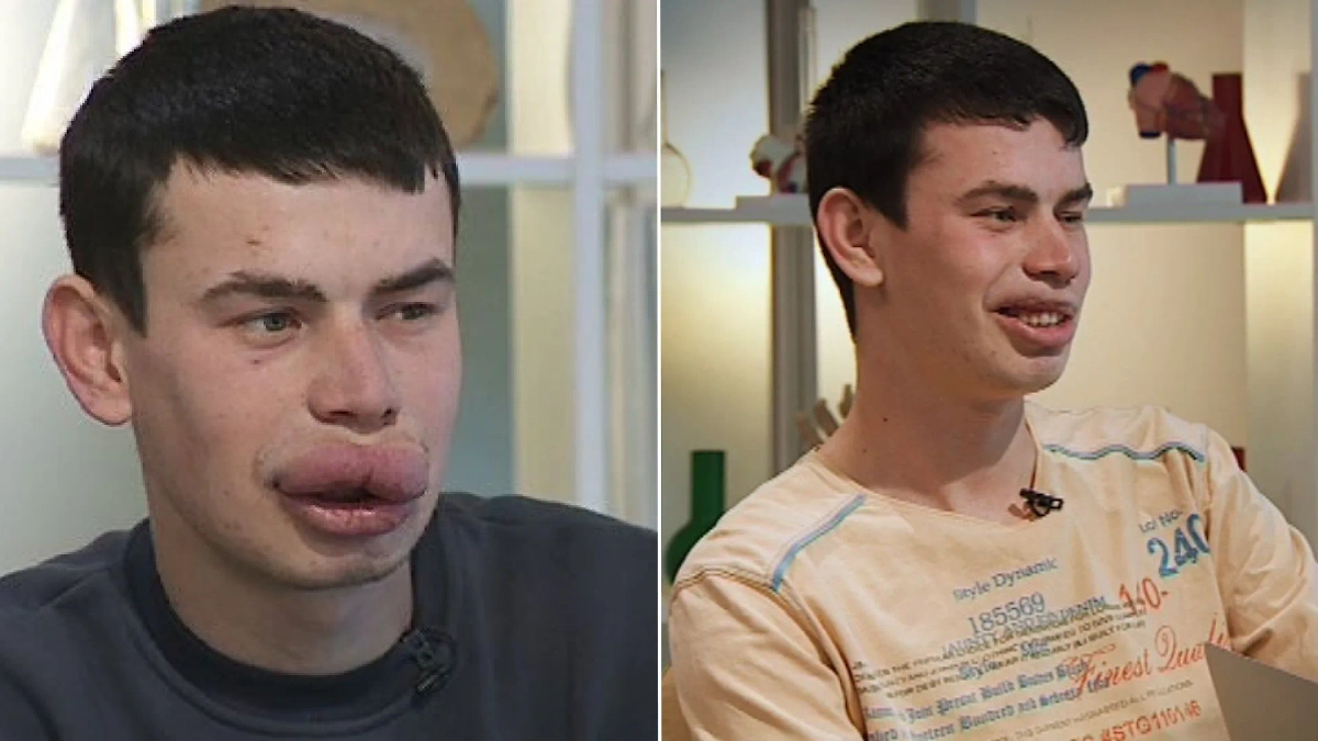 От отчаяния к надежде: пять удивительных преображений на медицинском проекте. Кадры из видео © YouTube / Телеканал СТБ