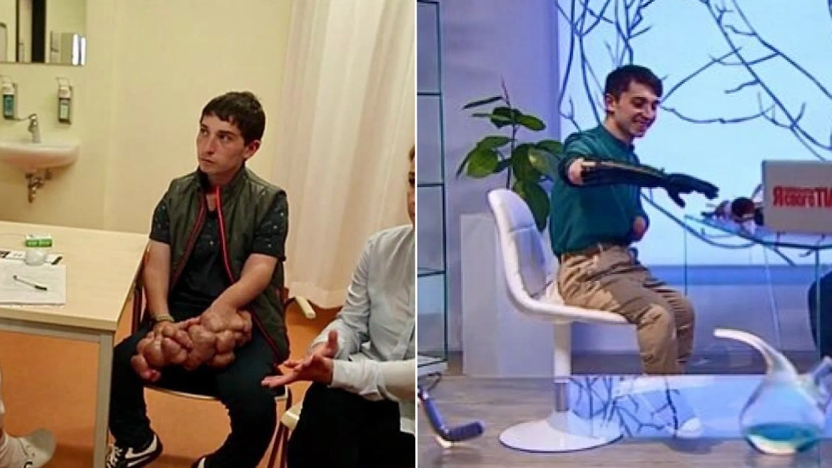 Как изменилась жизнь участников проекта «Я стесняюсь своего тела». Кадры из видео © YouTube / Телеканал СТБ