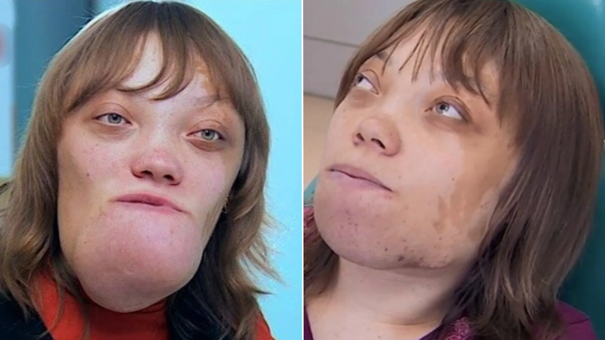 Участники шоу «Я стесняюсь своего тела»: самые поразительные изменения. Кадры из видео © YouTube / Телеканал СТБ