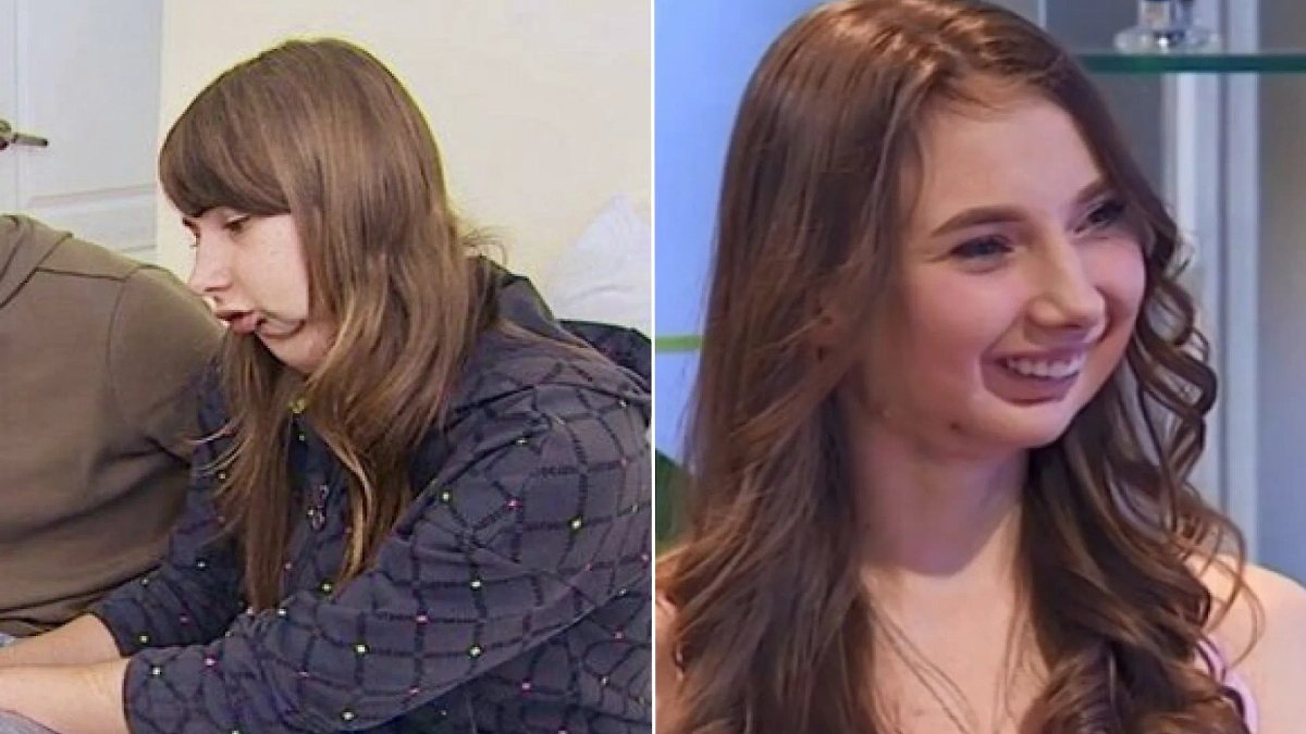 Невероятные трансформации героев медицинского шоу: топ-5 историй. Кадры из видео © YouTube / Телеканал СТБ