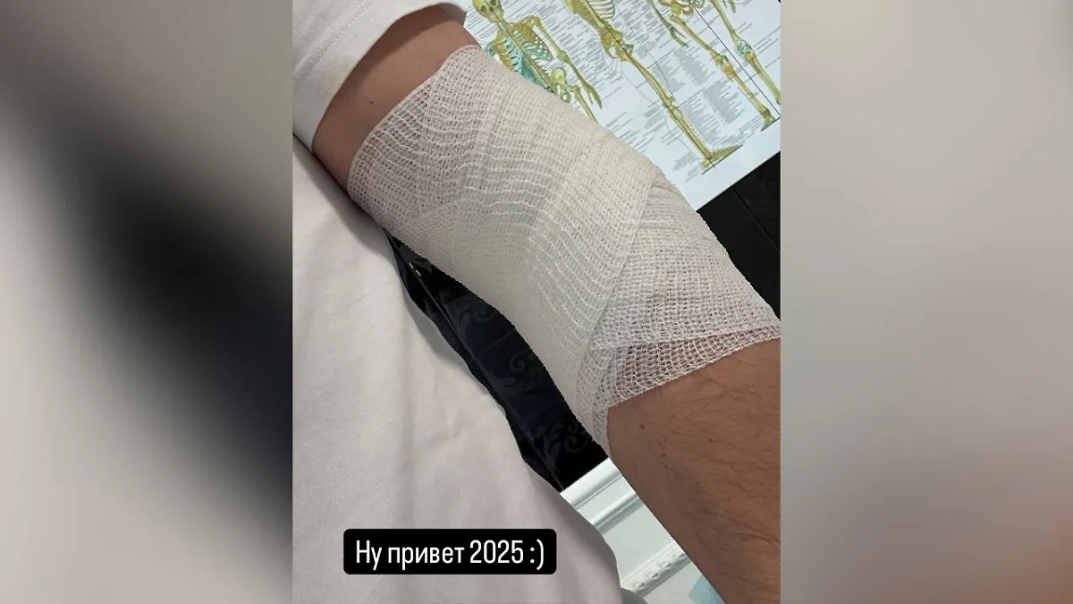Рука Родиона Газманова после операции. Фото © Instagram (соцсеть запрещена в РФ; принадлежит корпорации Meta, которая признана в РФ экстремистской) / rodder13