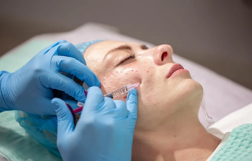 Стоит ли делать ботокс после 25 лет: мнение дерматологов. Фото © Shutterstock / FOTODOM / Vera Larina