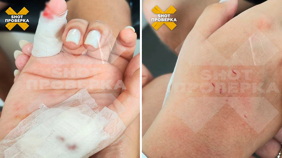 Акула напала на российскую туристку во время снорклинга на Мальдивах. Фото © Telegram / SHOT ПРОВЕРКА