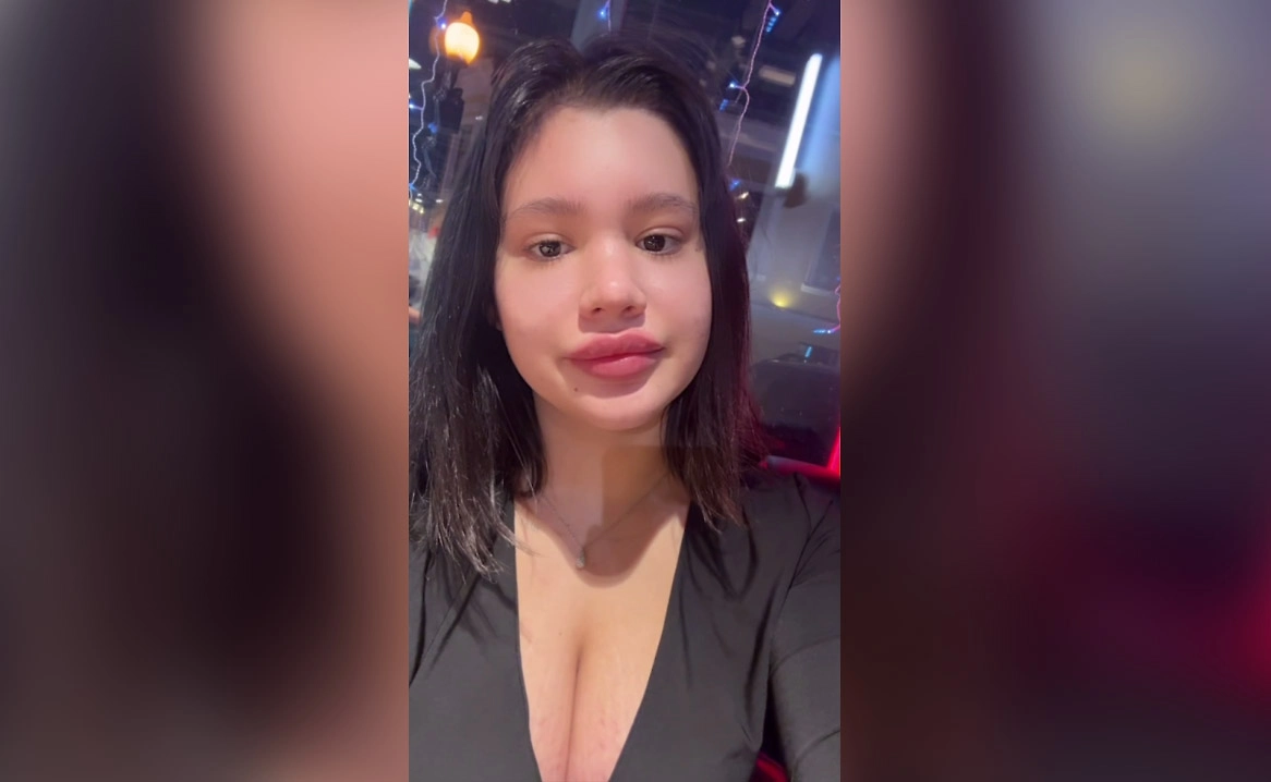 Дочь Даны Борисовой увеличила себе губы. Фото © Telegram / poxenovaa