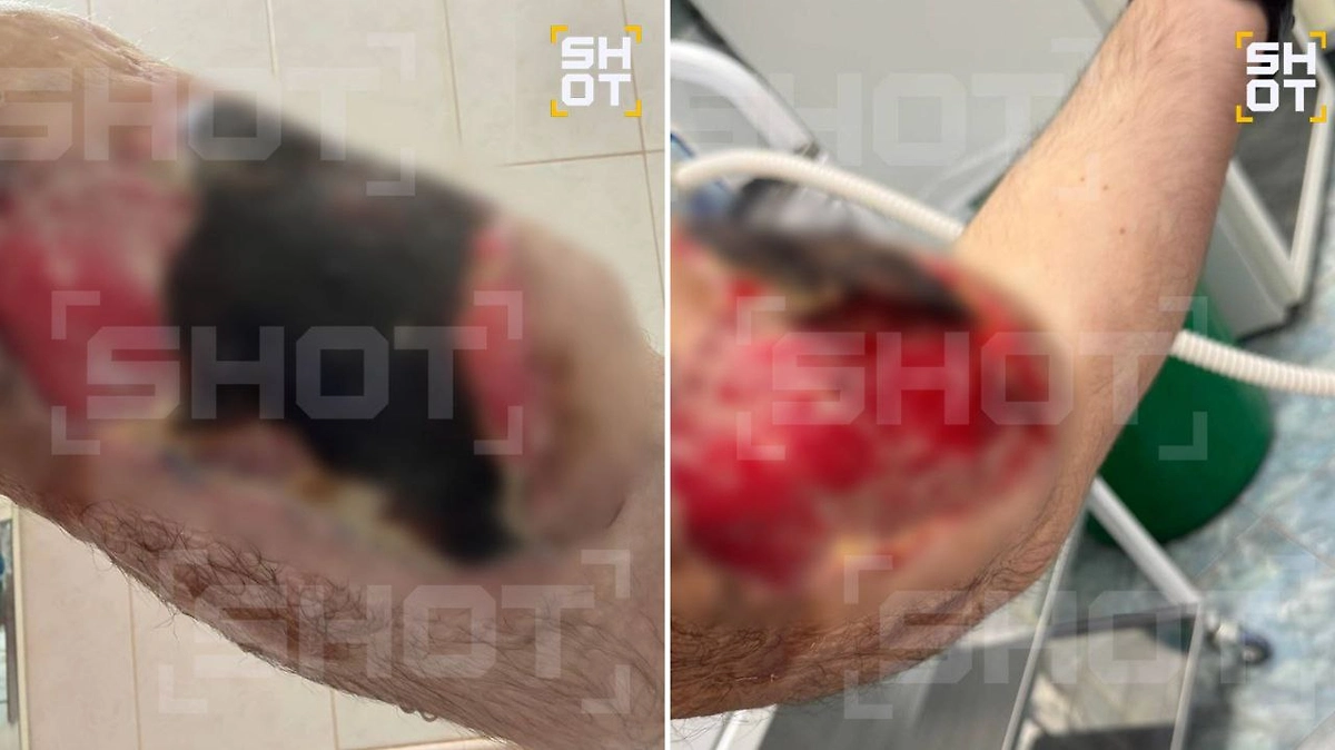 «Рукам-Базукам» грозит скорая ампутация. Фото © SHOT