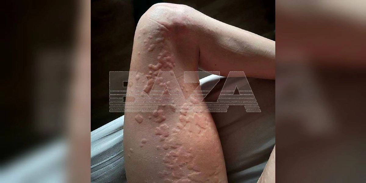 Последствия отдыха на Бали. Фото © Telegram / Baza