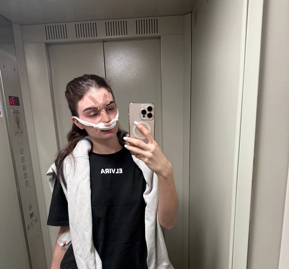 Пострадавшая от рук супруга жительница Омска. Фото © VK / Инцидент Омск 