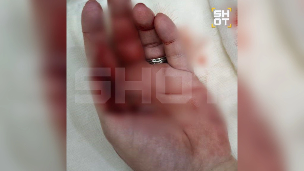 Российскую туристку на Мальдивах атаковала акула во время снорклинга. Фото © Telegram / SHOT