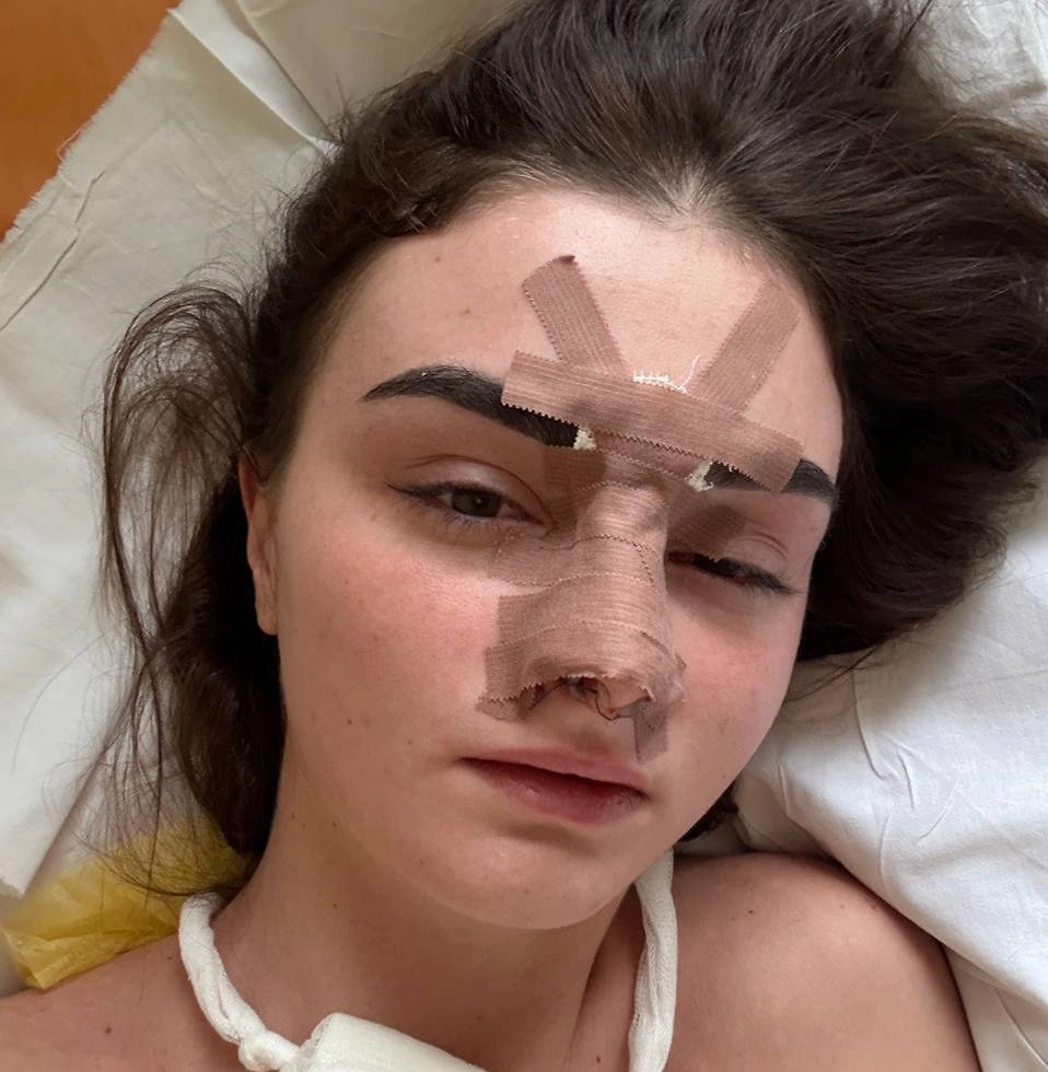 Пострадавшая от рук супруга жительница Омска. Фото © VK / Инцидент Омск 