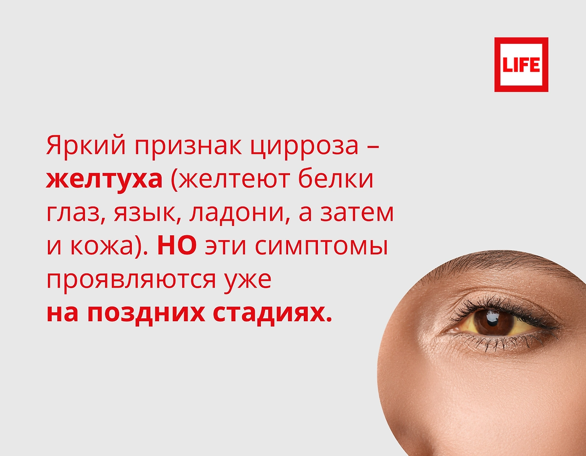 Врач заявила о «буме» цирроза в России. Всё о болезни. Фото © Life.ru