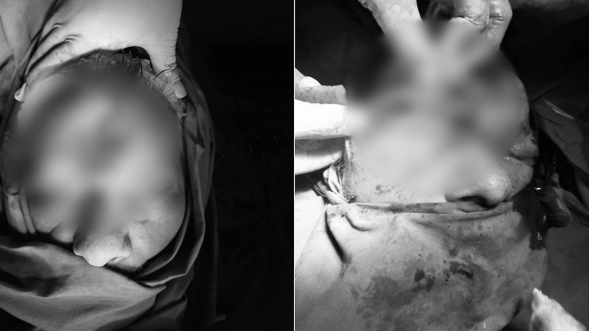 В Подмосковье врачи спасли мужчину с некрозом лба после драки. Фото © пресс-служба Красногорской больницы