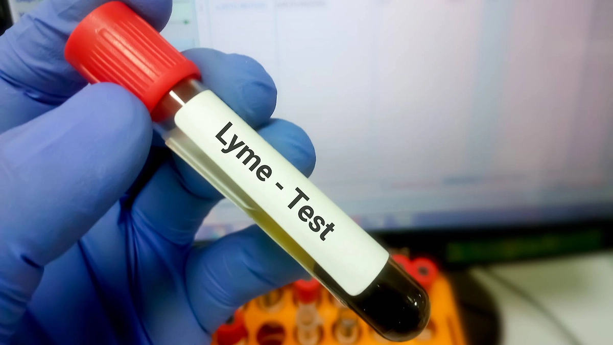 Правда ли, что с живой ёлкой на Новый год домой можно принести энцефалитного клеща? Фото © Shutterstock / FOTODOM / Saiful52