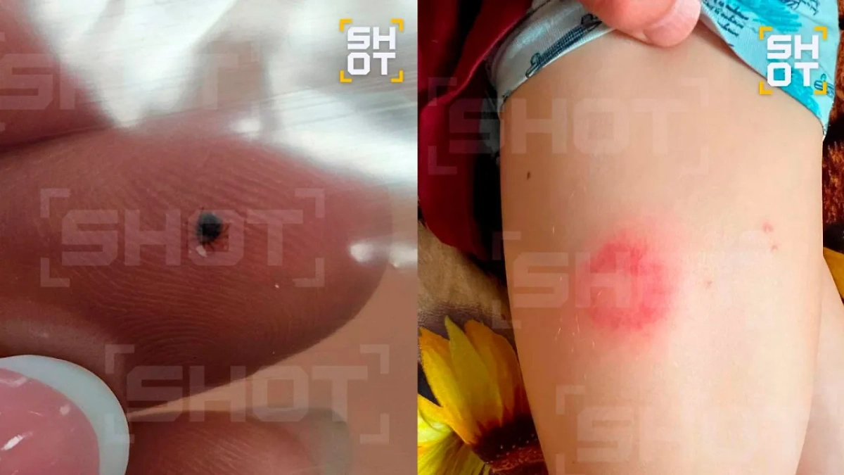 Клещи покусали российских туристов, отдыхающих на Пхукете. Обложка © SHOT