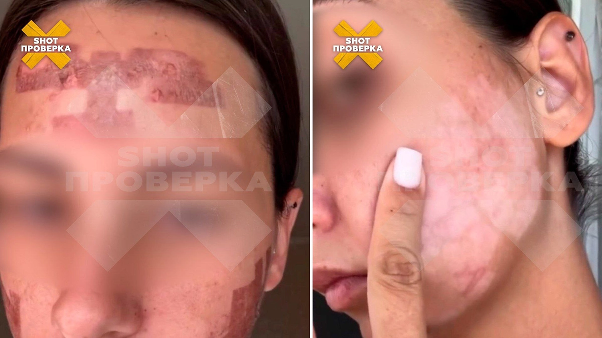 Пострадавшая девушка. Фото © Telegram / SHOT ПРОВЕРКА