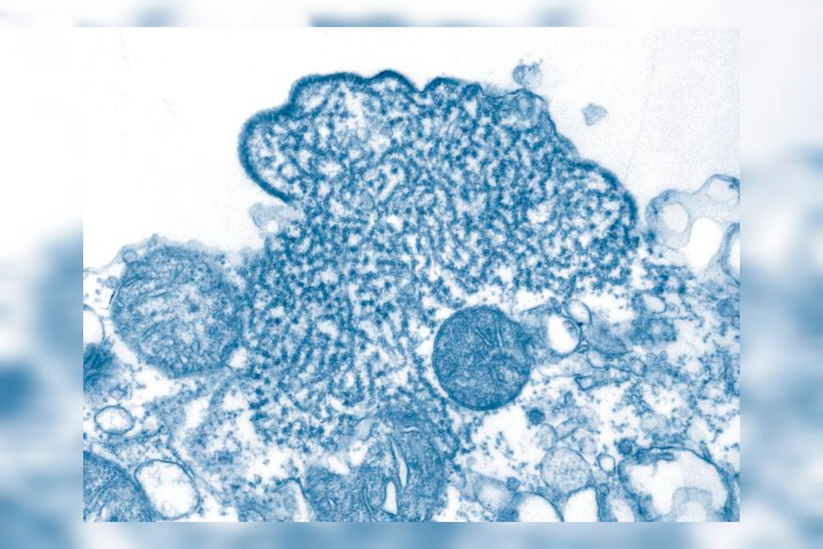 Как выглядит вирус Нипах. Фото © Wikipedia / CDC / C. S. Goldsmith, P. E. Rollin