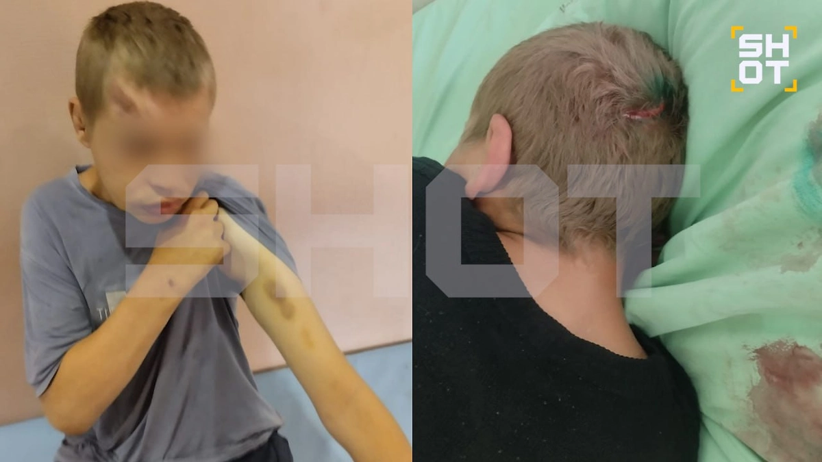 Постояльцев «прокопьевского чистилища» жестоко избивали и держели на цепи. Фото © Telegram / SHOT