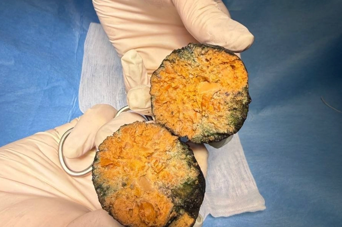 Фото © РКБ им. Семашко