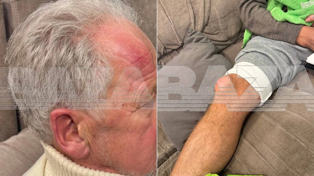 Последствия стычки с актёром. Фото © Telegram / Baza