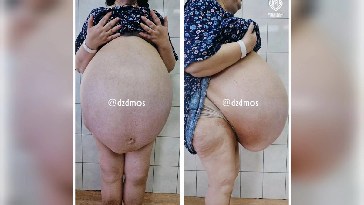 Фото © Telegram / Московская медицина