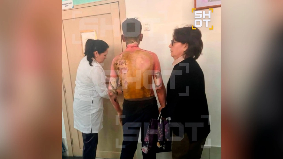 Один из школьников, который пострадал при пожаре устроенном восьмиклассницей в красноярской школе. Фото © SHOT