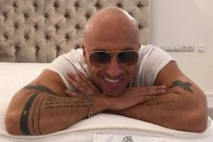 Стоматолог оценила протезирование у Нагиева и посоветовала не брать с него пример