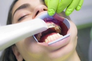 Молодые россияне массово устанавливают брекеты, чтобы выглядеть успешными