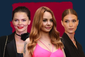 5 звёзд, у которых есть дефекты внешности, а вы и не замечали