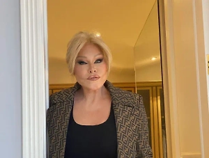 «Женщина-кошка» из Швейцарии показала себя до пластики, и это фото разобьёт вам сердце